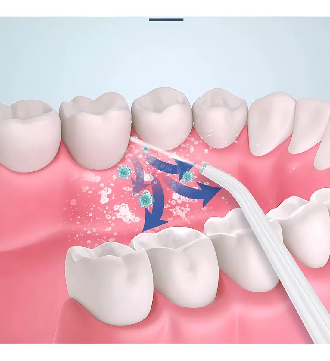 IRRIGADOR BUCAL 4